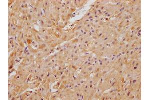 IHC image of ABIN7175041 diluted at 1:100 and staining in paraffin-embedded human heart tissue performed on a Leica BondTM system. (C22ORF39 antibody  (AA 1-142))