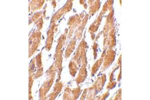 Immunohistochemistry of GPR44 in human heart tissue with GPR44 polyclonal antibody  at 2.