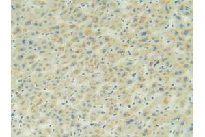 IHC-P analysis of Human Liver Tissue, with DAB staining.