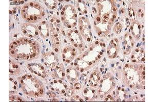 Image no. 10 for anti-Myc Proto-Oncogene protein (MYC) antibody (ABIN1497013) (c-MYC antibody)