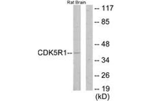 Western blot analysis of extracts from rat brain cells, using CDK5R1 Antibody.