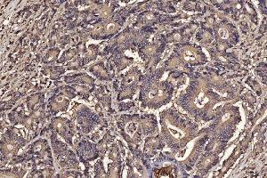 IHC analysis of PDIA6 using anti-PDIA6 antibody (ABIN7600554). (PDIA6 antibody  (AA 20-440))