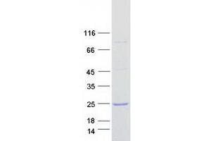 Validation with Western Blot (Cofilin 2 Protein (CFL2) (Transcript Variant 2) (Myc-DYKDDDDK Tag))