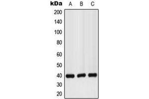 Western blot analysis of GPR160 expression in LO2 (A), mouse liver (B), rat kidney (C) whole cell lysates.