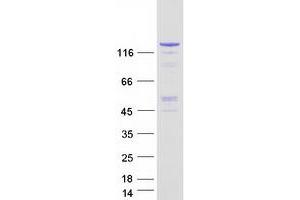 Validation with Western Blot