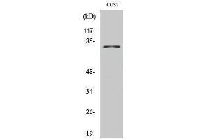 Western Blotting (WB) image for anti-Tyrosinase (TYR) (C-Term) antibody (ABIN3177845) (TYR antibody  (C-Term))
