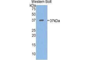 Western Blotting (WB) image for Periplakin (PPL) ELISA Kit (ABIN6720505)