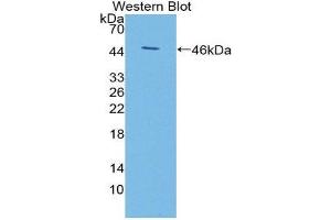 Western Blotting (WB) image for anti-KiSS-1 Metastasis-Suppressor (KISS1) (AA 1-126) antibody (ABIN1868842) (KISS1 antibody  (AA 1-126))