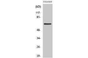 Western Blotting (WB) image for anti-Coenzyme Q8A (COQ8A) (Internal Region) antibody (ABIN3183601) (COQ8A antibody  (Internal Region))