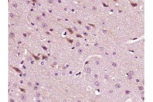 Paraformaldehyde-fixed, paraffin embedded mouse brain, Antigen retrieval by boiling in sodium citrate buffer (pH6) for 15min, Block endogenous peroxidase by 3% hydrogen peroxide for 30 minutes,  Blocking buffer (normal goat serum) at 37°C for 20min, Antibody incubation with LPCAT2 Polyclonal Antibody (bs-10742R) at 1:400 overnight at 4°C, followed by a conjugated secondary and DAB staining. (LPCAT2 antibody  (AA 131-230))