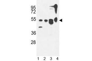 ATG13 antibody western blot analysis in 1) MDA-MB435,2) CEM, 3) T47D cell line and 4) mouse cerebellum tissue lysate. (ATG13 antibody  (AA 1-30))