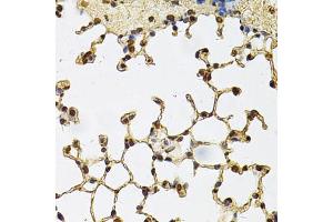 Immunohistochemistry of paraffin-embedded mouse lung using IFI16 Antibody. (IFI16 antibody)
