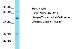 Host: Rabbit Target Name: TMEM199 Sample Tissue: Human Jurkat Whole Cell Antibody Dilution: 1ug/ml (TMEM199 antibody  (N-Term))