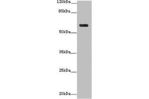 Western blot All lanes: EHD1 antibody at 12 μg/mL + MDA-MB-231 whole cell lysate Secondary Goat polyclonal to rabbit IgG at 1/10000 dilution Predicted band size: 61 kDa Observed band size: 61 kDa (EHD1 antibody  (AA 401-498))