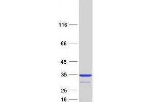Carbonic Anhydrase III (CA3) protein (Myc-DYKDDDDK Tag)
