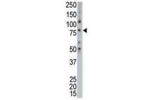Image no. 1 for anti-TPX2, Microtubule-Associated, Homolog (Xenopus Laevis) (TPX2) (C-Term) antibody (ABIN357426) (TPX2 antibody  (C-Term))
