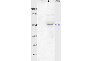 L1 rat kidney lysates, L2 rat brain lysates probed (ABIN738396) Anti-ChRM1/Acetylcholine receptor(M1) Polyclonal, Unconjugated at 1:200 in 4 °C. (CHRM1 antibody  (AA 321-420))