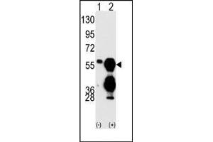 Image no. 1 for anti-Protein Phosphatase 1F (PP2C Domain Containing) (PPM1F) (C-Term) antibody (ABIN360801) (PPM1F antibody  (C-Term))