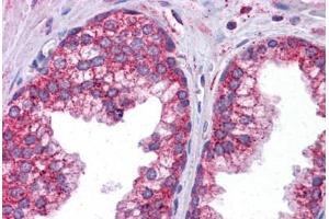 Human Prostate: Formalin-Fixed, Paraffin-Embedded (FFPE) (STAT6 antibody  (AA 614-663))