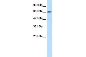 Western Blot showing ZNF499 antibody used at a concentration of 1-2 ug/ml to detect its target protein. (ZBTB45 antibody  (Middle Region))