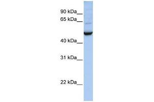 IDH1 antibody used at 1 ug/ml to detect target protein.