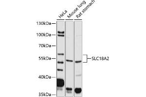 Western blot analysis of extracts of various cell lines, using SLC18 antibody (799) at 1:2000 dilution.