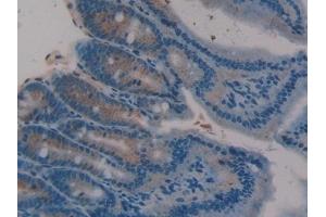 Detection of TFF3 in Rat Intestine Tissue using Polyclonal Antibody to Trefoil Factor 3 (TFF3) (TFF3 antibody  (AA 23-81))