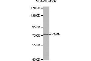 Western blot analysis of extracts of MDA-MB-453s cell lines, using PARN antibody.