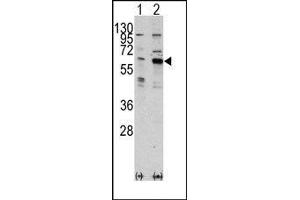 Image no. 1 for anti-PAK3 (PAK3) (Middle Region) antibody (ABIN360320) (PAK3 antibody  (Middle Region))