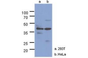 Western Blotting (WB) image for anti-N-Acetylglucosamine Kinase (NAGK) antibody (ABIN1490756) (NAGK antibody)