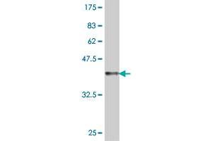 Western Blot detection against Immunogen (37. (CLPP antibody  (AA 178-277))