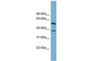 Image no. 1 for anti-Hepatic and Glial Cell Adhesion Molecule (HEPACAM) (AA 107-156) antibody (ABIN6743842) (HEPACAM antibody  (AA 107-156))