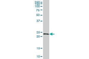 RPE MaxPab polyclonal antibody. (RPE antibody  (AA 1-228))