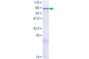 Acyl-CoA Dehydrogenase Family, Member 9 (ACAD9) (AA 1-621) protein (GST tag)