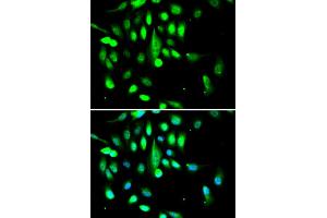 Immunofluorescence analysis of A549 cells using CDK1 antibody. (CDK1 antibody)