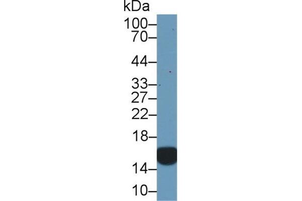 CRABP2 antibody  (AA 1-138)