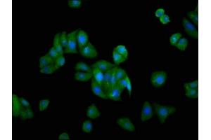 Immunofluorescence staining of HepG2 cells with ABIN7153297 at 1:166, counter-stained with DAPI. (GRK5 antibody  (AA 406-590))