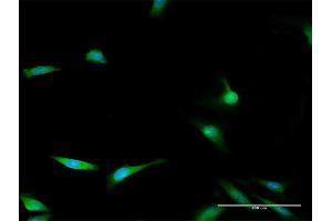 Immunofluorescence of purified MaxPab antibody to ENOPH1 on HeLa cell. (MASA antibody  (AA 1-261))