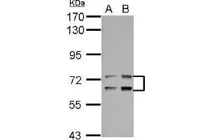 WB Image Sample (30 ug of whole cell lysate) A: Jurkat B: Raji 7. (LTA4H antibody)