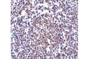 Immunohistochemistry of Aven in human spleen tissue with Aven antibody at 5 μg/ml. (AVEN antibody  (C-Term))