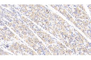 Detection of ABCF1 in Human Stomach Tissue using Polyclonal Antibody to ATP Binding Cassette Transporter F1 (ABCF1) (ABCF1 antibody  (AA 625-845))