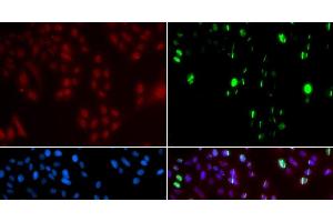 Immunofluorescence analysis of GFP-RNF168 transgenic U2OS cells using FANCD2 Polyclonal Antibody (FANCD2 antibody)