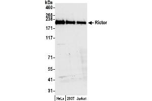 Western Blotting (WB) image for anti-RPTOR Independent Companion of mTOR, Complex 2 (RICTOR) (C-Term) antibody (ABIN7454633) (RICTOR antibody  (C-Term))