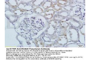 Formalin-fixed and paraffin embedded rat kidney labeled with Anti RAB20 Polyclonal Antibody, Unconjugated  at 1:200 followed by conjugation to the secondary antibody and DAB staining (RAB20 antibody  (AA 131-234))