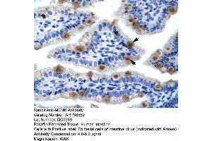 Human Lung (MCM6 antibody  (C-Term))