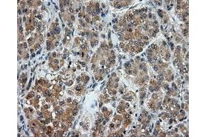 Image no. 5 for anti-Lipase, Endothelial (LIPG) antibody (ABIN1499165)