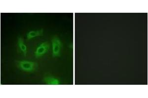 Immunofluorescence (IF) image for anti-Transforming Growth Factor, beta Receptor 1 (TGFBR1) (AA 131-180) antibody (ABIN2888904) (TGFBR1 antibody  (AA 131-180))