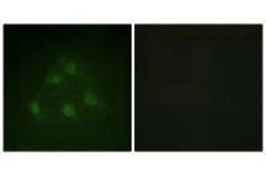 Immunofluorescence analysis of HeLa cells, using Smad1 (Ab-187) antibody. (SMAD1 antibody  (Ser187))