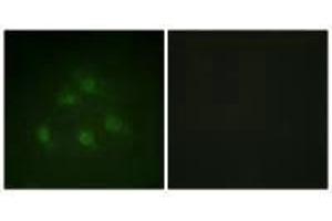 Immunofluorescence (IF) image for anti-SMAD, Mothers Against DPP Homolog 1 (SMAD1) (Ser187) antibody (ABIN7180082)