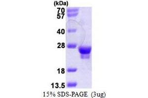 RAB18 Protein (AA 1-206) (His tag)